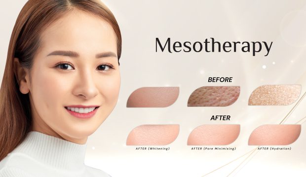 web-banner-1920x1080-Mesotheraphy